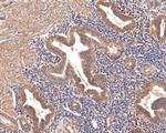 TSLP Receptor Antibody in Immunohistochemistry (Paraffin) (IHC (P))