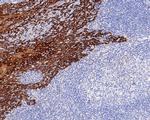 Cytokeratin 5/6 Antibody in Immunohistochemistry (Paraffin) (IHC (P))