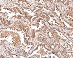 Cytokeratin 5/6 Antibody in Immunohistochemistry (Paraffin) (IHC (P))