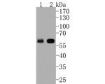 Cytokeratin 5/6 Antibody in Western Blot (WB)