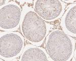 HMGB2 Antibody in Immunohistochemistry (Paraffin) (IHC (P))