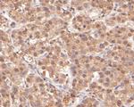 H3K4me1 Antibody in Immunohistochemistry (Paraffin) (IHC (P))