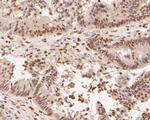 H3K4me1 Antibody in Immunohistochemistry (Paraffin) (IHC (P))