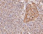 H3K4me1 Antibody in Immunohistochemistry (Paraffin) (IHC (P))