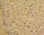 HSPA9 Antibody in Immunohistochemistry (Paraffin) (IHC (P))