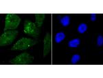 WDR5 Antibody in Immunocytochemistry (ICC/IF)