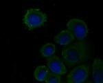 PLCG2 Antibody in Immunocytochemistry (ICC/IF)