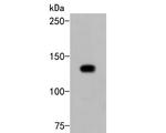 PLCG2 Antibody in Western Blot (WB)