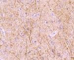 NF-H Antibody in Immunohistochemistry (Paraffin) (IHC (P))