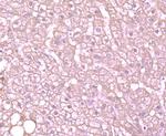 ALDH1A1 Antibody in Immunohistochemistry (Paraffin) (IHC (P))