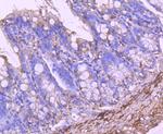 ALDH1A1 Antibody in Immunohistochemistry (Paraffin) (IHC (P))