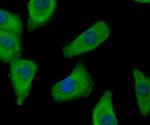 FASN Antibody in Immunocytochemistry (ICC/IF)