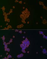ATG5 Antibody in Immunocytochemistry (ICC/IF)