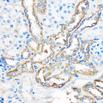 ATG5 Antibody in Immunohistochemistry (Paraffin) (IHC (P))