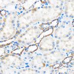 ATG5 Antibody in Immunohistochemistry (Paraffin) (IHC (P))