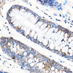 ATG5 Antibody in Immunohistochemistry (Paraffin) (IHC (P))