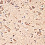 BAX Antibody in Immunohistochemistry (Paraffin) (IHC (P))