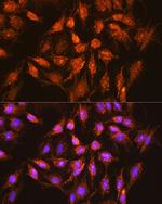 BCL-XL Antibody in Immunocytochemistry (ICC/IF)