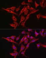 Caspase 3 Antibody in Immunocytochemistry (ICC/IF)