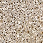 PPAR gamma Antibody in Immunohistochemistry (Paraffin) (IHC (P))