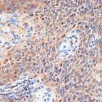 CDK2 Antibody in Immunohistochemistry (Paraffin) (IHC (P))