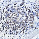 p73 Antibody in Immunohistochemistry (Paraffin) (IHC (P))