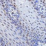 p73 Antibody in Immunohistochemistry (Paraffin) (IHC (P))