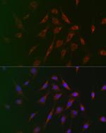 TSC2 Antibody in Immunocytochemistry (ICC/IF)