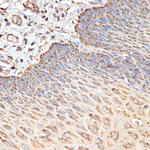 TSC2 Antibody in Immunohistochemistry (Paraffin) (IHC (P))