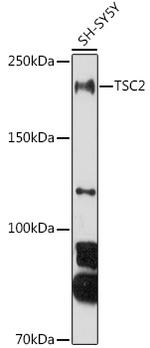 TSC2 Antibody in Western Blot (WB)