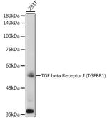 TGFBR1 Antibody in Western Blot (WB)