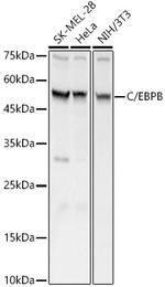 C/EBP beta Antibody in Western Blot (WB)