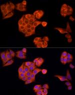 APAF1 Antibody in Immunocytochemistry (ICC/IF)