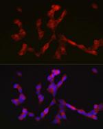 ALK Antibody in Immunocytochemistry (ICC/IF)