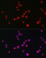 ALK Antibody in Immunocytochemistry (ICC/IF)