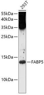 FABP5 Antibody in Western Blot (WB)