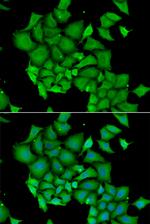 ICAD Antibody in Immunocytochemistry (ICC/IF)