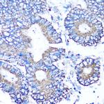 MMP16 Antibody in Immunohistochemistry (Paraffin) (IHC (P))