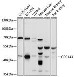 GPR143 Antibody in Western Blot (WB)