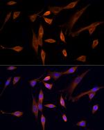 MST3 Antibody in Immunocytochemistry (ICC/IF)