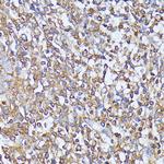 MST3 Antibody in Immunohistochemistry (Paraffin) (IHC (P))