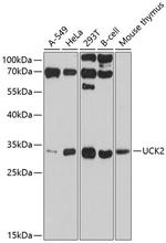 UCK2 Antibody in Western Blot (WB)