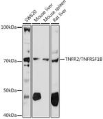 TNFR2 Antibody in Western Blot (WB)