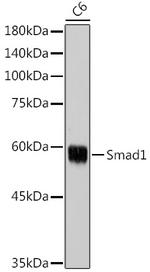 SMAD1 Antibody in Western Blot (WB)