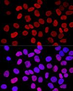 Histone H2A.X Antibody in Immunocytochemistry (ICC/IF)