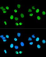 Histone H2A.X Antibody in Immunocytochemistry (ICC/IF)