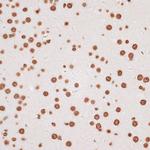 Histone H2A.X Antibody in Immunohistochemistry (Paraffin) (IHC (P))