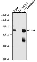 YAP1 Antibody in Immunoprecipitation (IP)