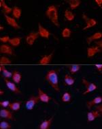 Caspase 8 Antibody in Immunocytochemistry (ICC/IF)