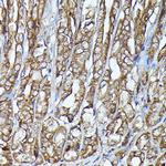 JAK2 Antibody in Immunohistochemistry (Paraffin) (IHC (P))